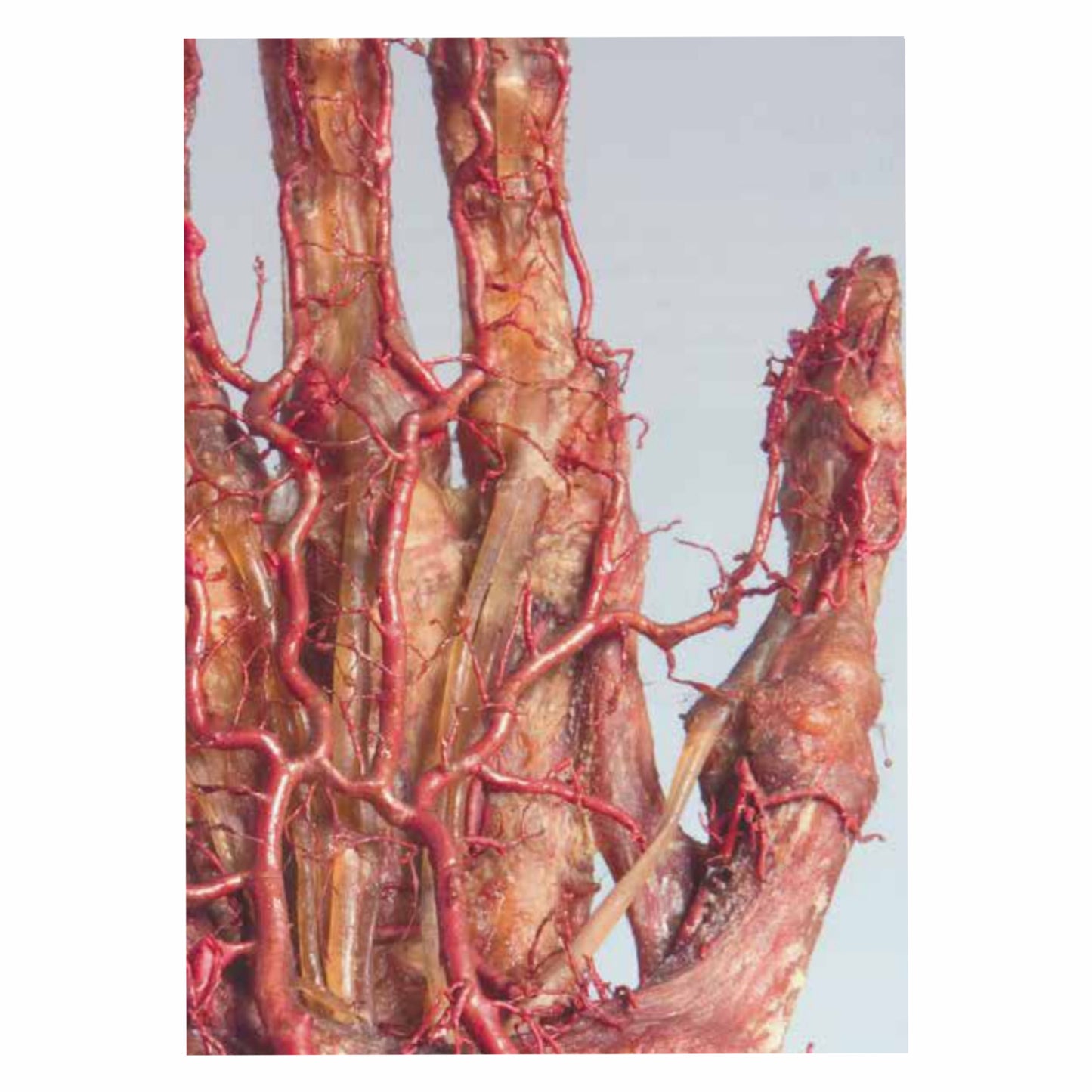 Hand Blood Vessels Postcard