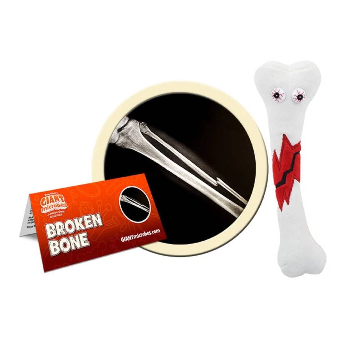 Broken Bone